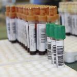 Health insurance for second homes in Italy